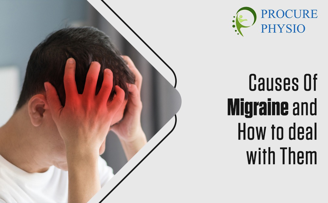 Causes Of Migraines and How to deal with Them - Procure Physiotherapy burlington