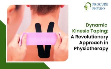 Dynamic Kinesio Taping: A Revolutionary Approach in Physiotherapy