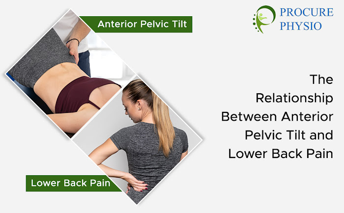 Anterior Pelvic Tilt and Lower Back Pain